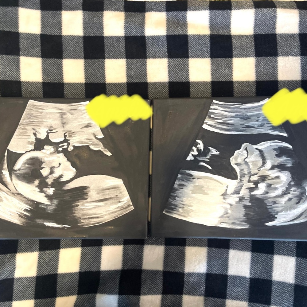 Custom ultrasound painting